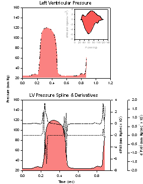 Ventricular Pressure